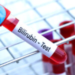 Что такое билирубин? Arimed