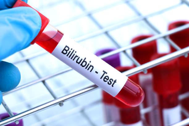 Что такое билирубин?