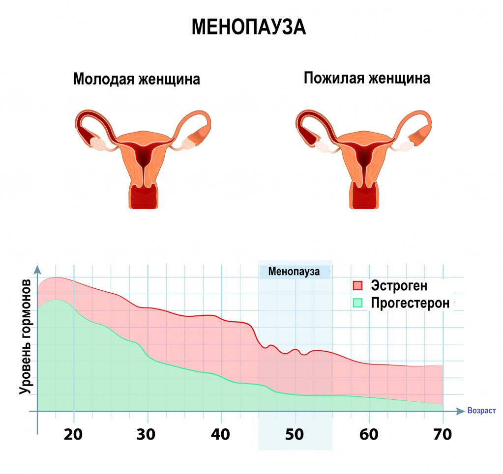 Кровомазанье в постменопаузе.