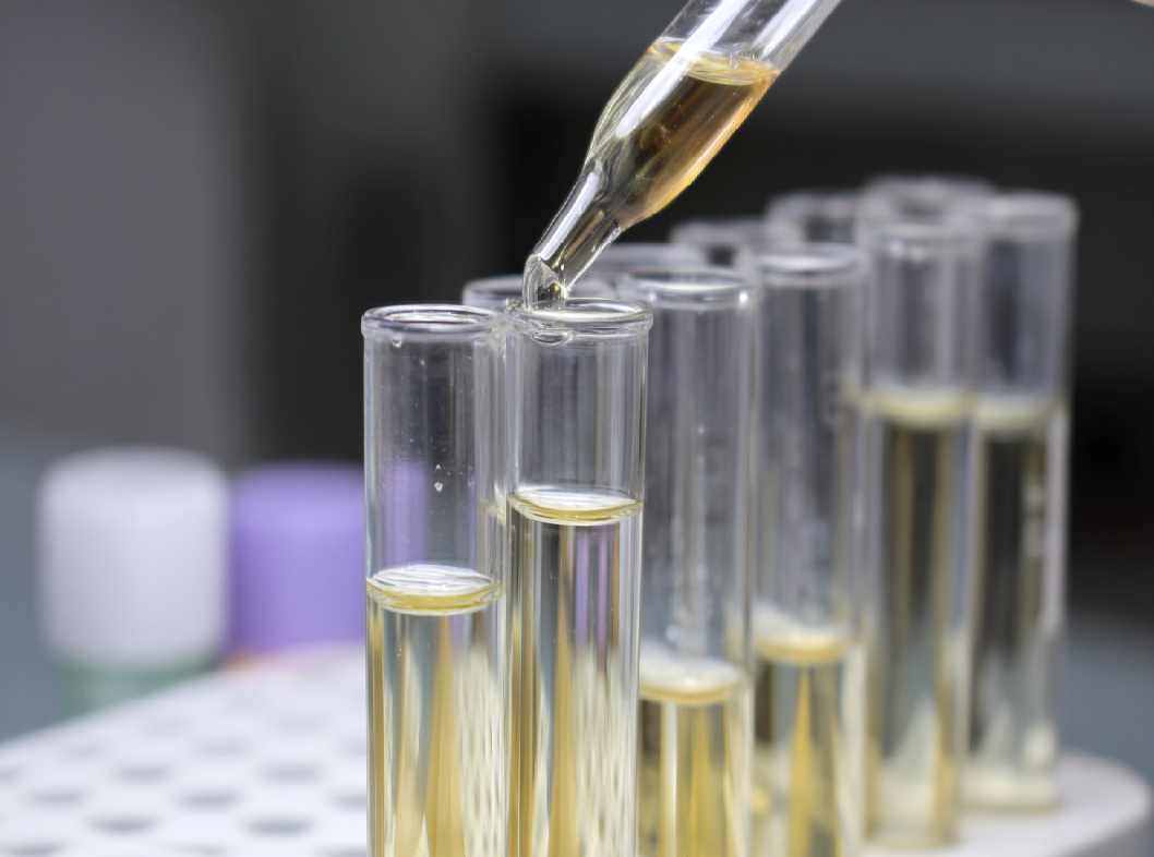 Анализ на амилазу