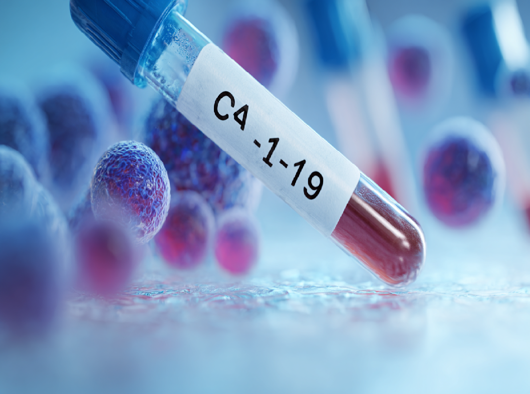 Онкомаркер СА-19.9