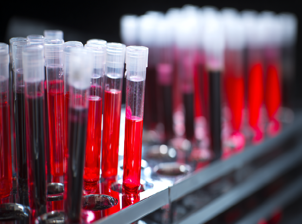 Покажет ли кровь на антитела гельминтов?