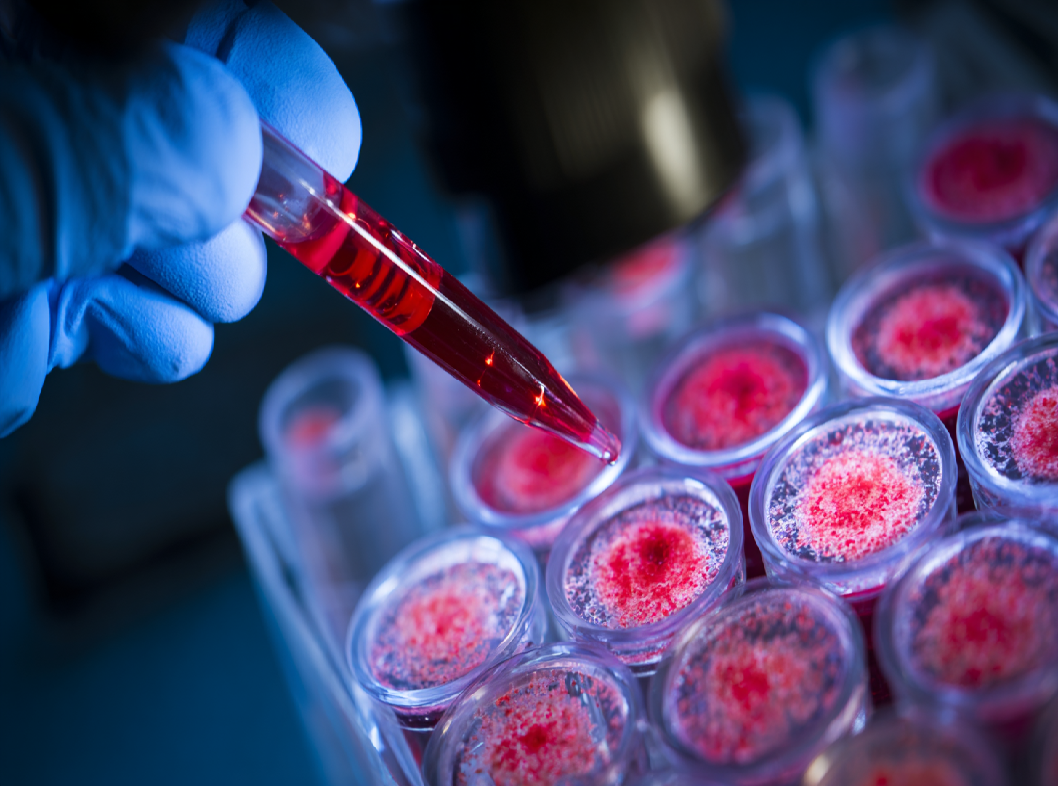 Покажет ли кровь на антитела гельминтов?