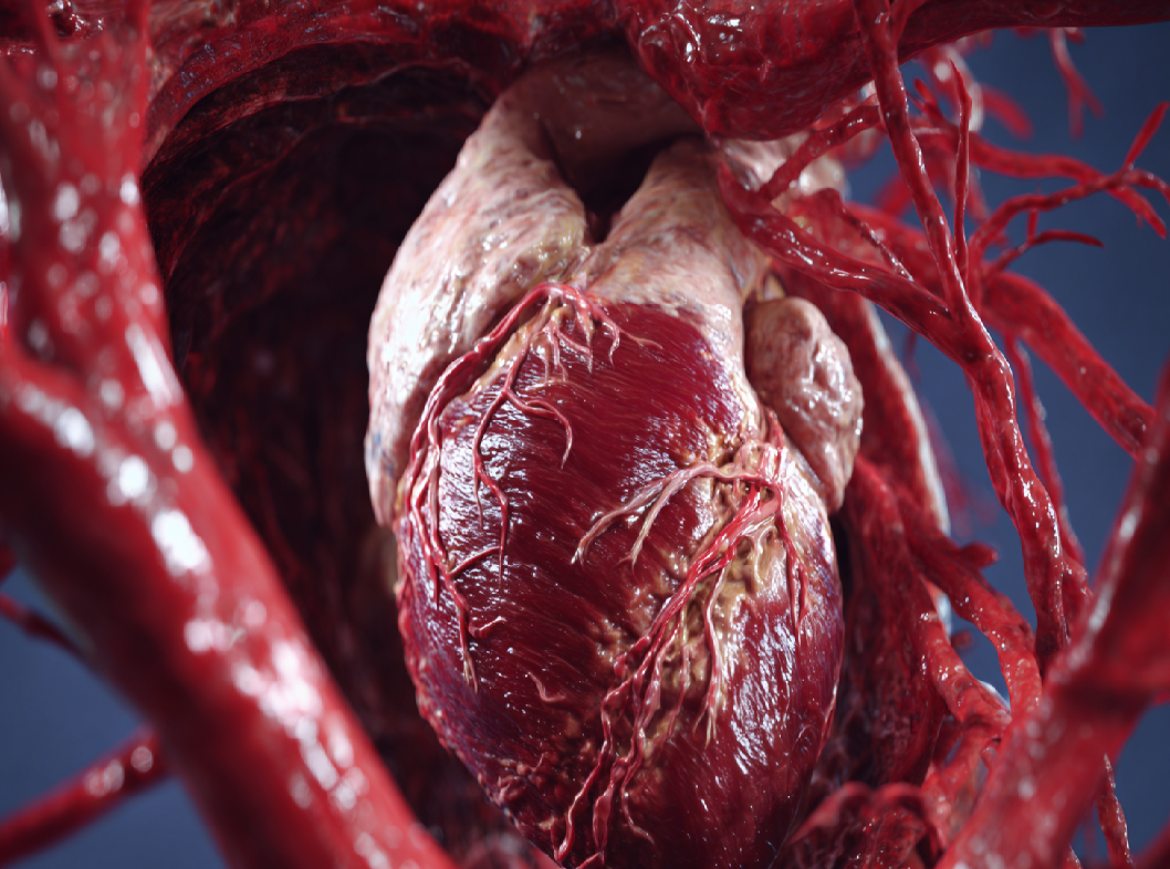 Аневризма аорты