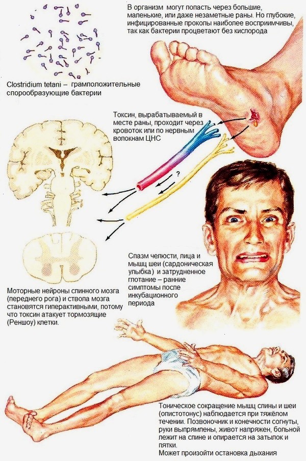 Существует заболевание