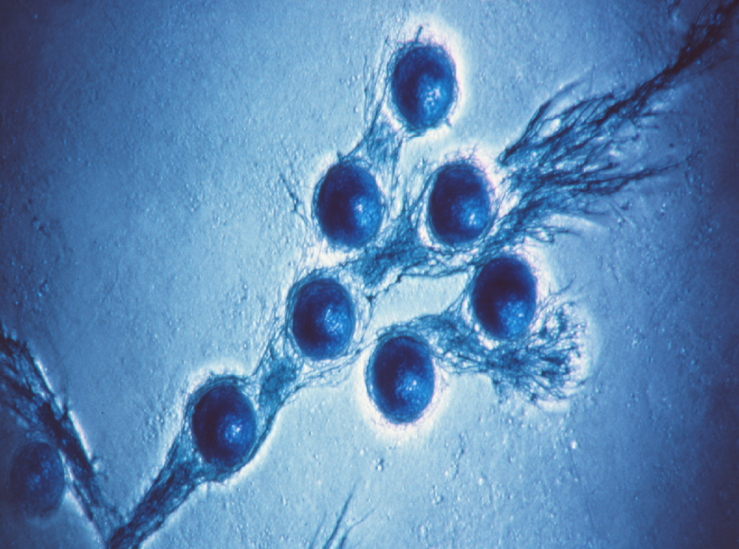 Антиспермальные антитела