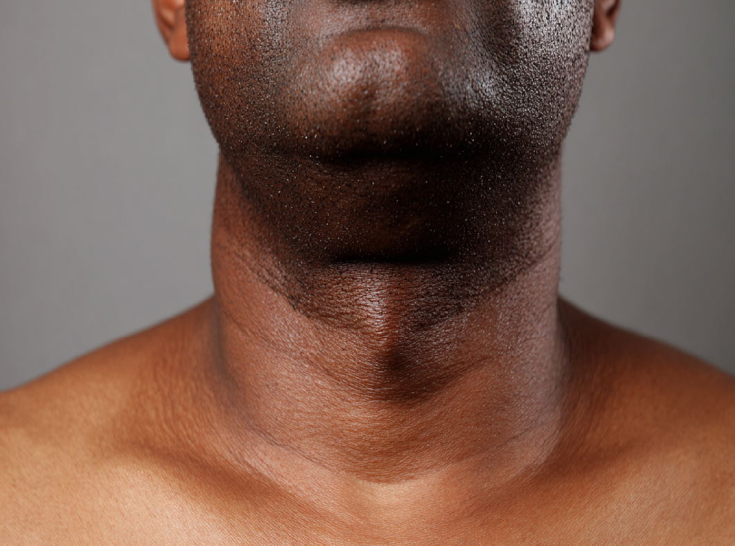 Причины увеличения лимфоузлов