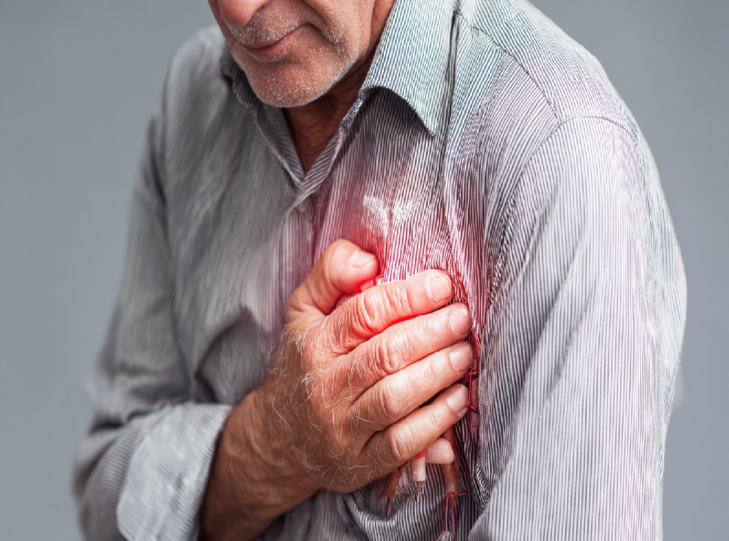 Острый коронарный синдром