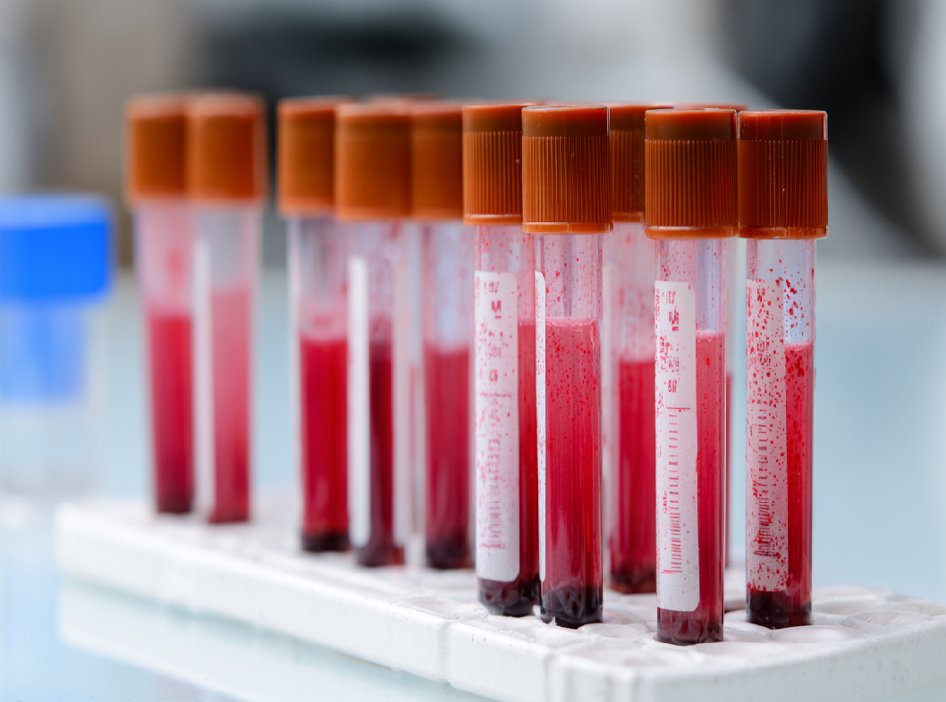 Что такое АЧТВ?