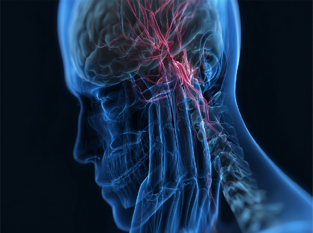 Невралгия тройничного нерва