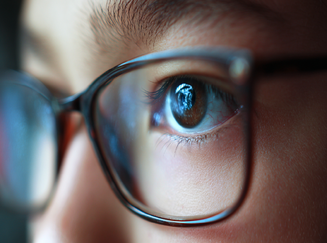 Близорукость