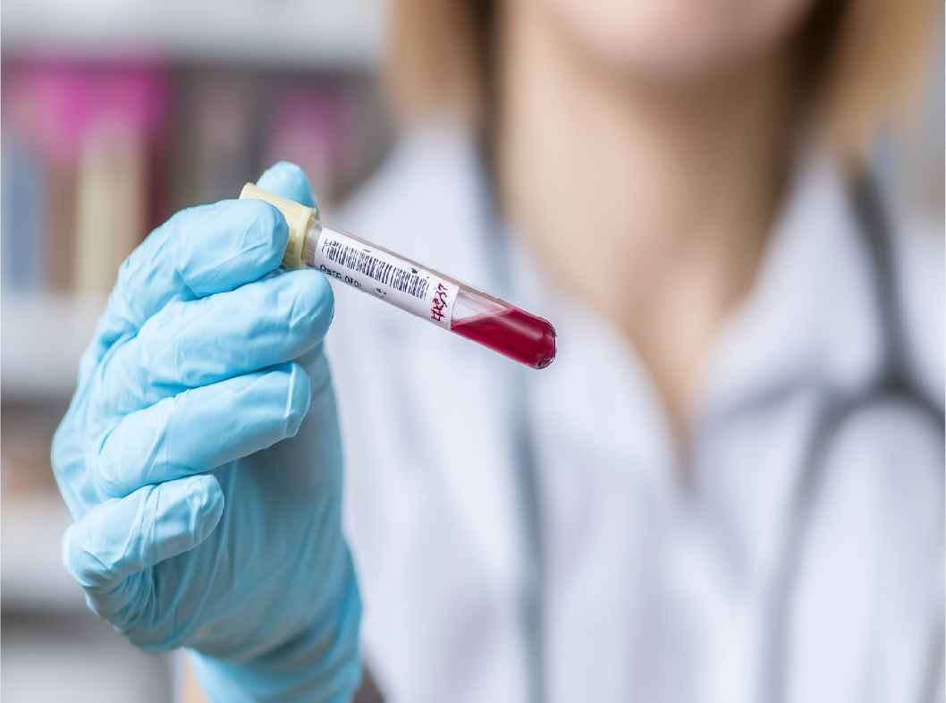 Анализ на гепатит B