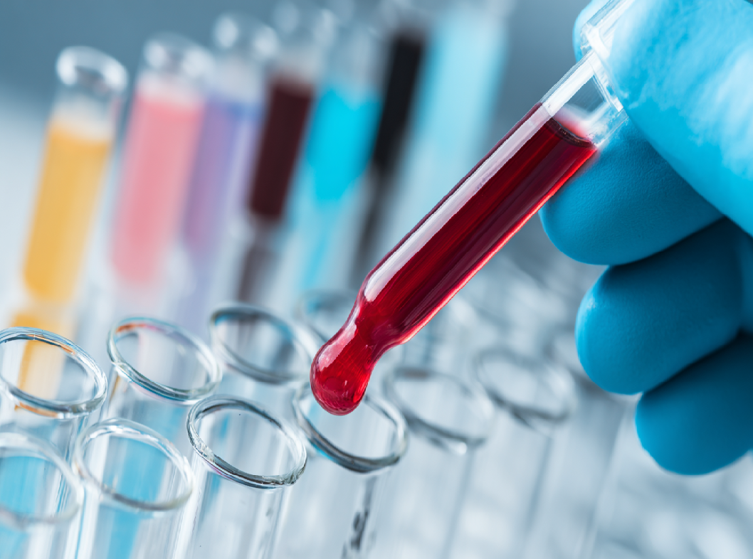 Анализ на сифилис