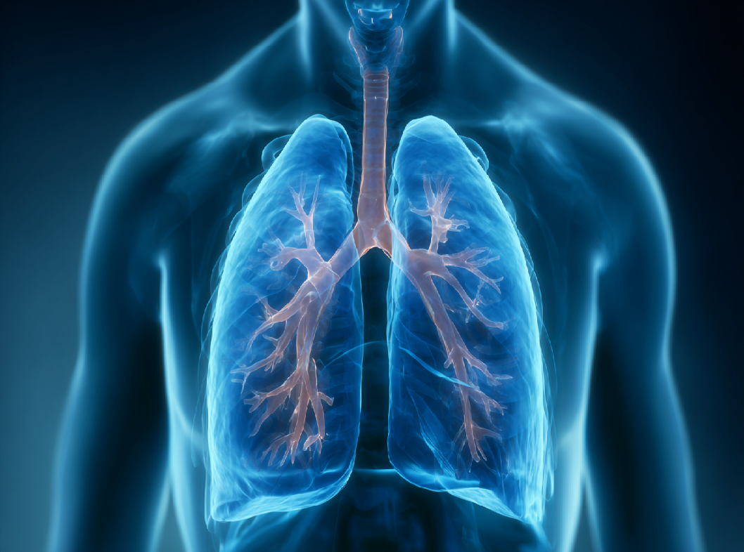 Пневмоторакс