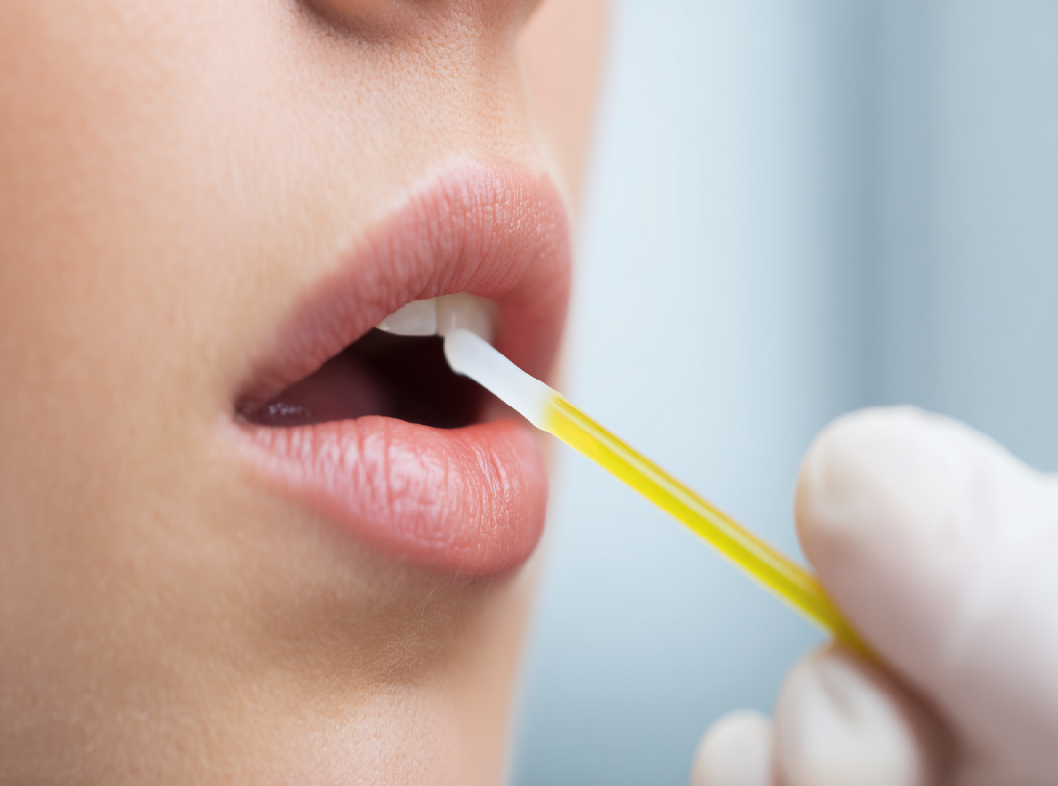 Анализ на сифилис