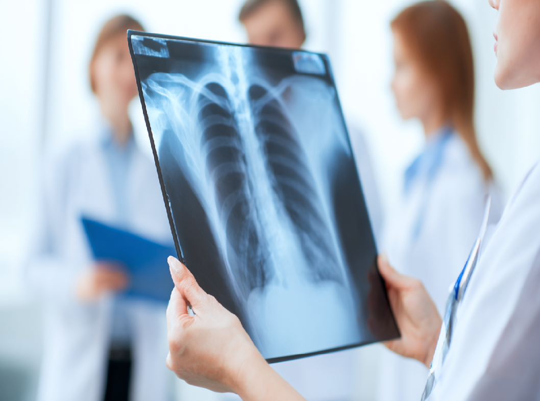 Зачем делать рентгенографию