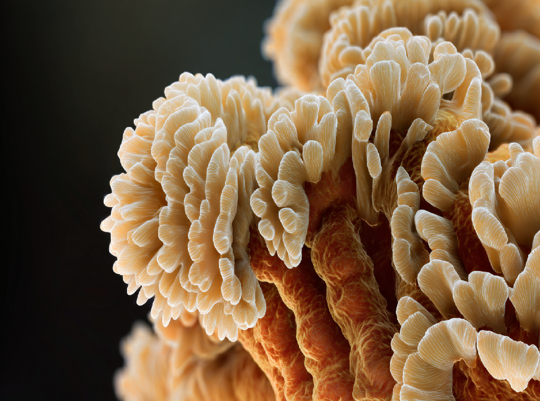 Полип толстой кишки