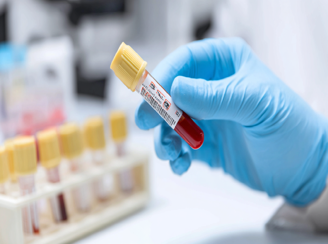 Анализ на гепатит B