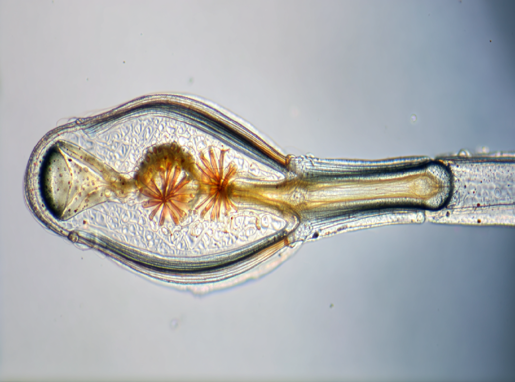 Сальпингоофорит