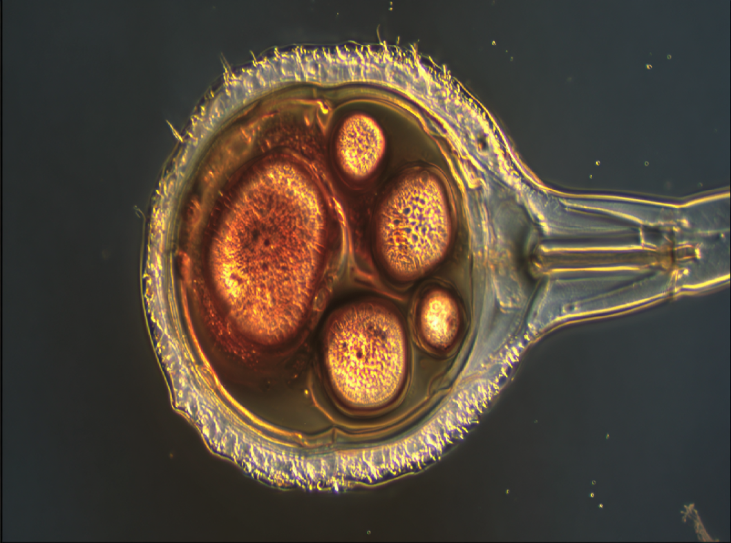 Сальпингоофорит