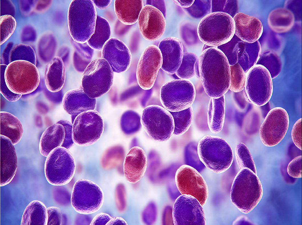 Синдром барабанных палочек