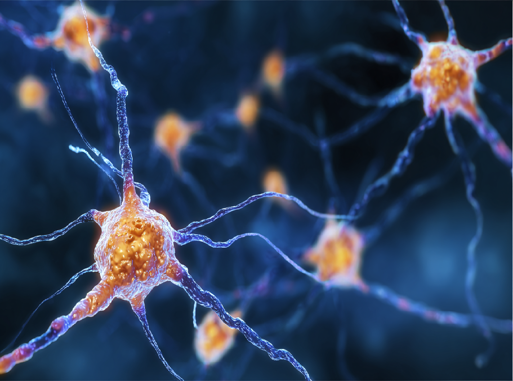 Рассеянный склероз