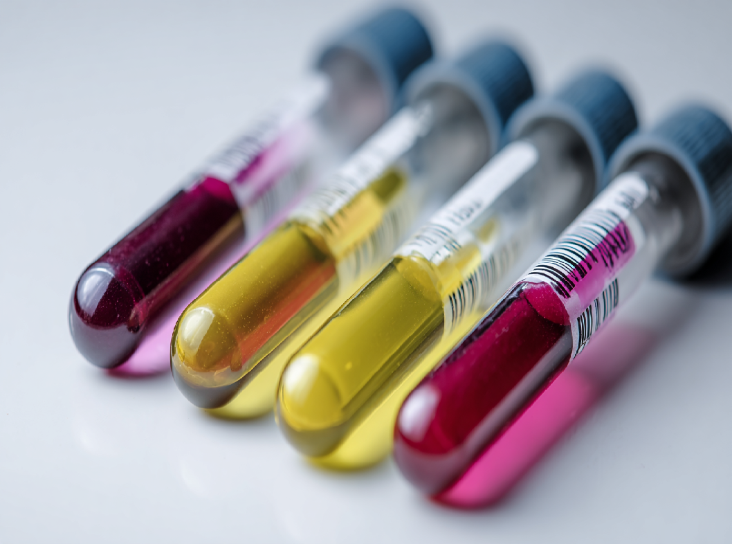 Анализ на фруктозамин