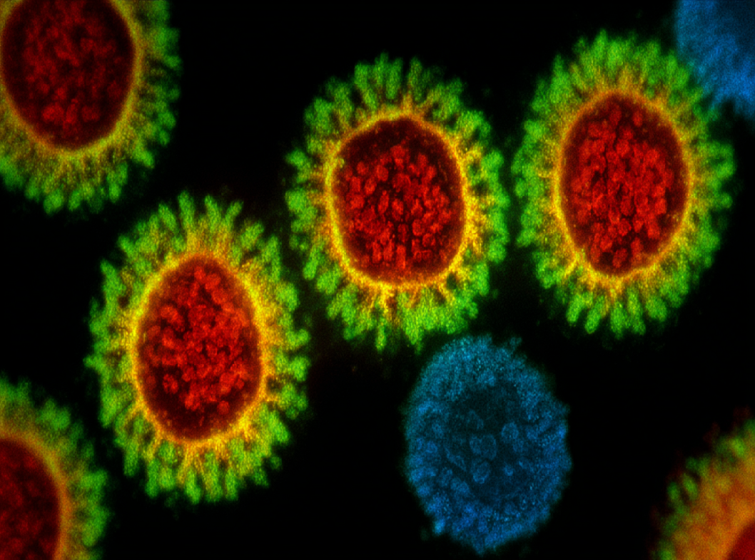 Цитомегаловирус