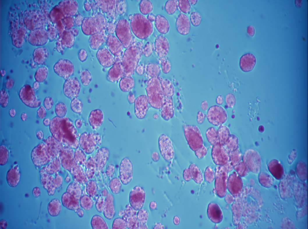 Антистрептолизин-О (АСЛО)