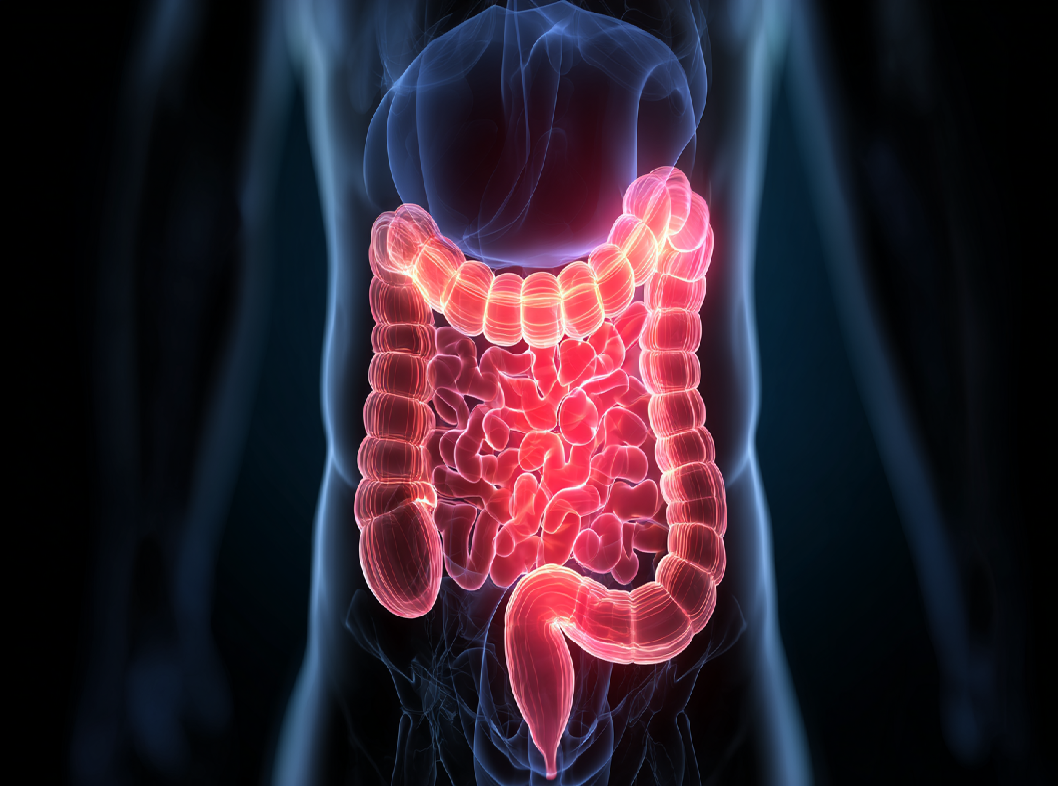 Воспаление толстой кишки