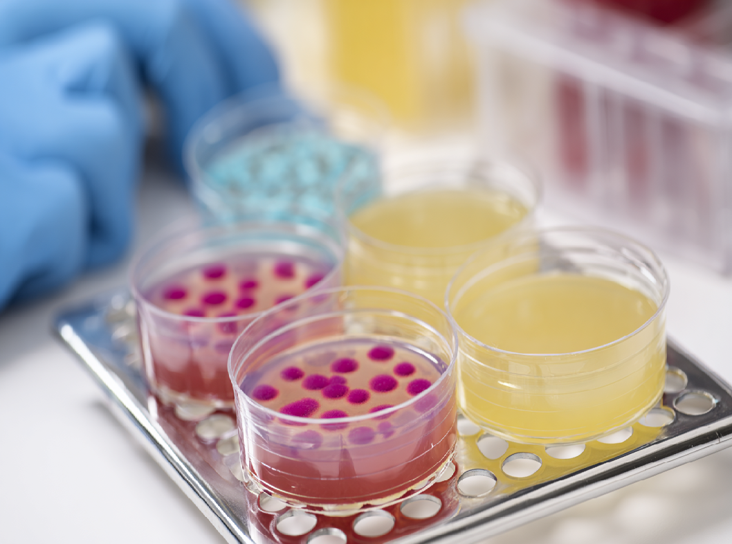 Анализ на стрептококк группы В