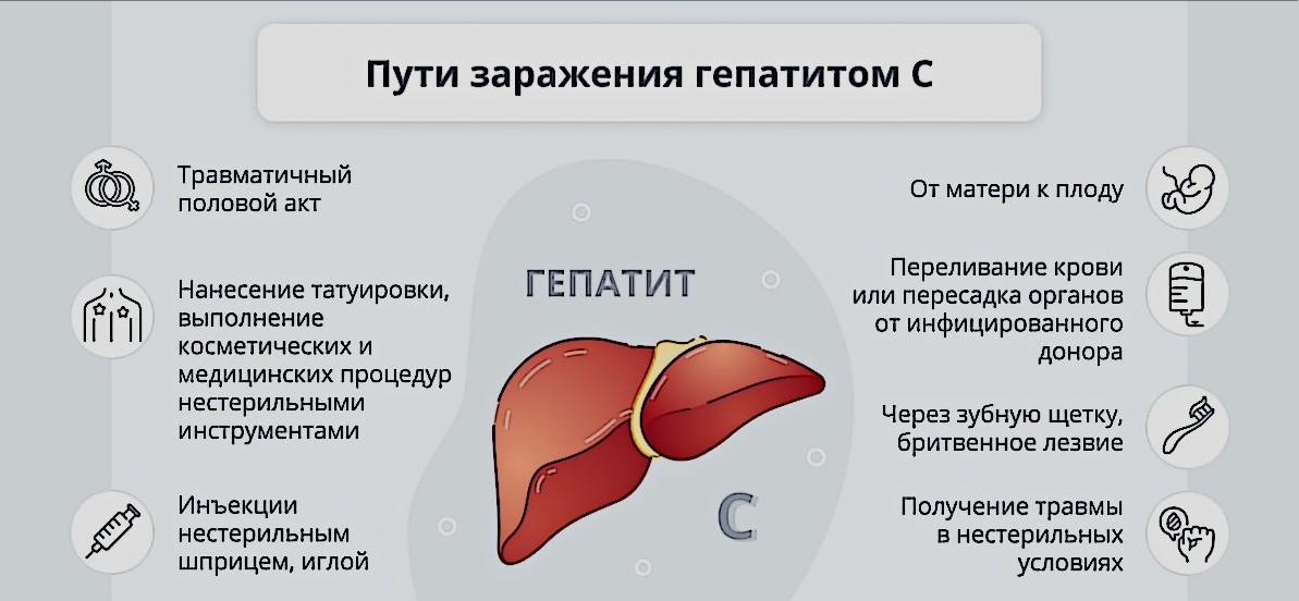 Анализ на гепатит C