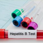 Анализ на гепатит B Arimed