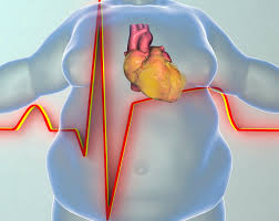 Хроническая сердечная недостаточность на фоне ожирения