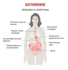 Отметь какие признаки