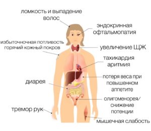 Болезнь по симптомам