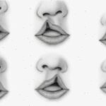 Заячья губа (расщелина губы) Arimed