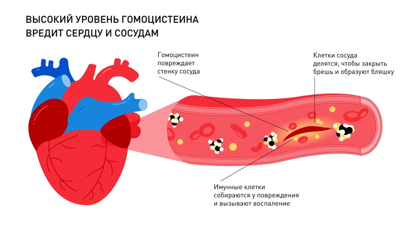 гомоцистеин