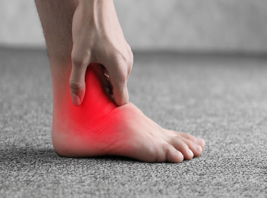 Маршевая стопа (или маршевая болячка) – это состояние, которое характеризуется болями и дискомфортом в области стопы