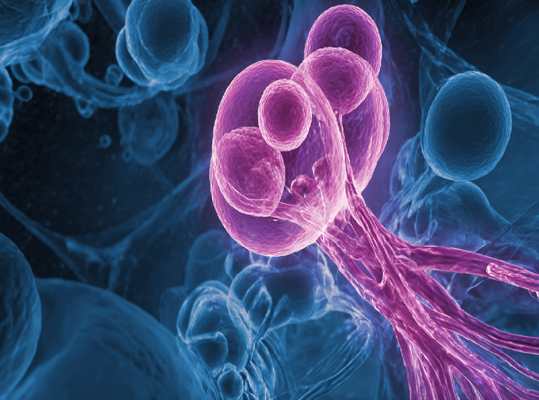 Причины образования полипов в матке