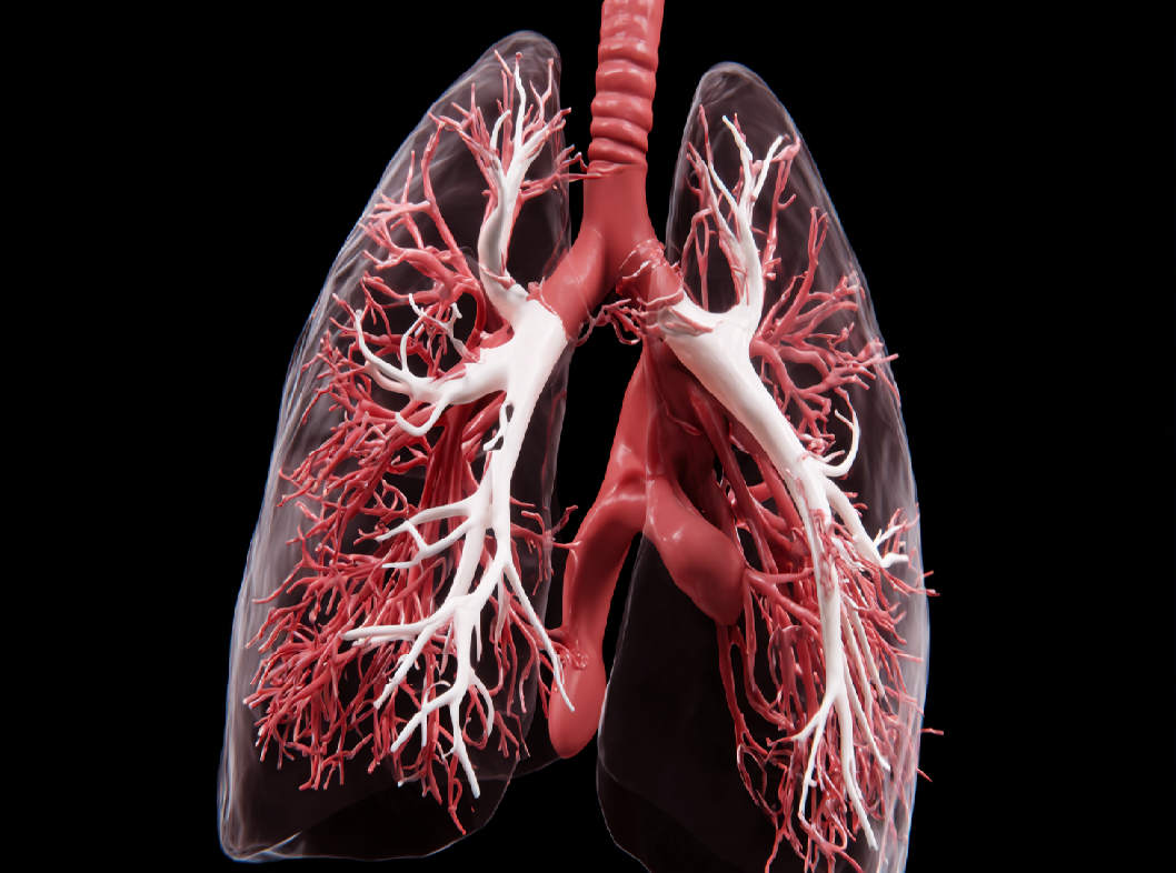 Тромбоэмболия легочных артерий