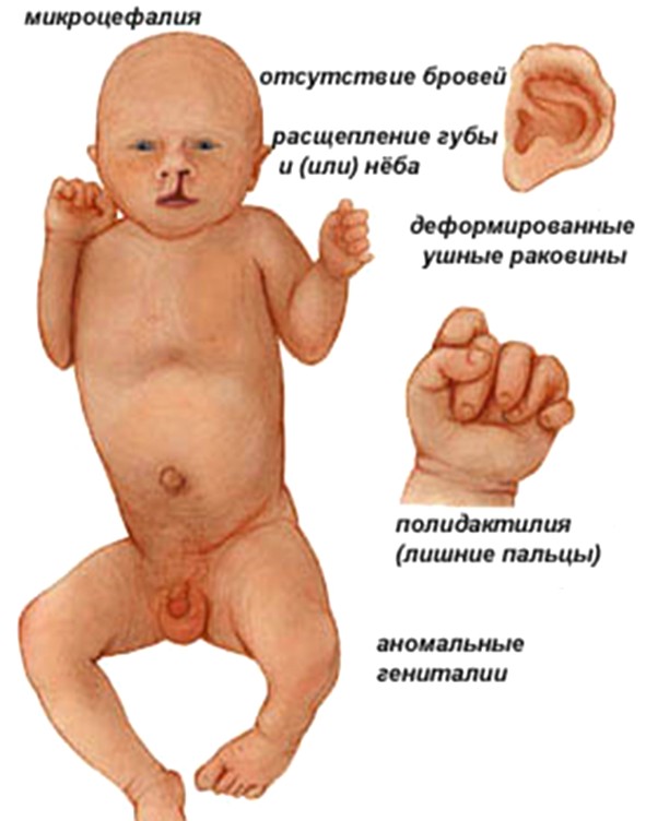 эдвардса
