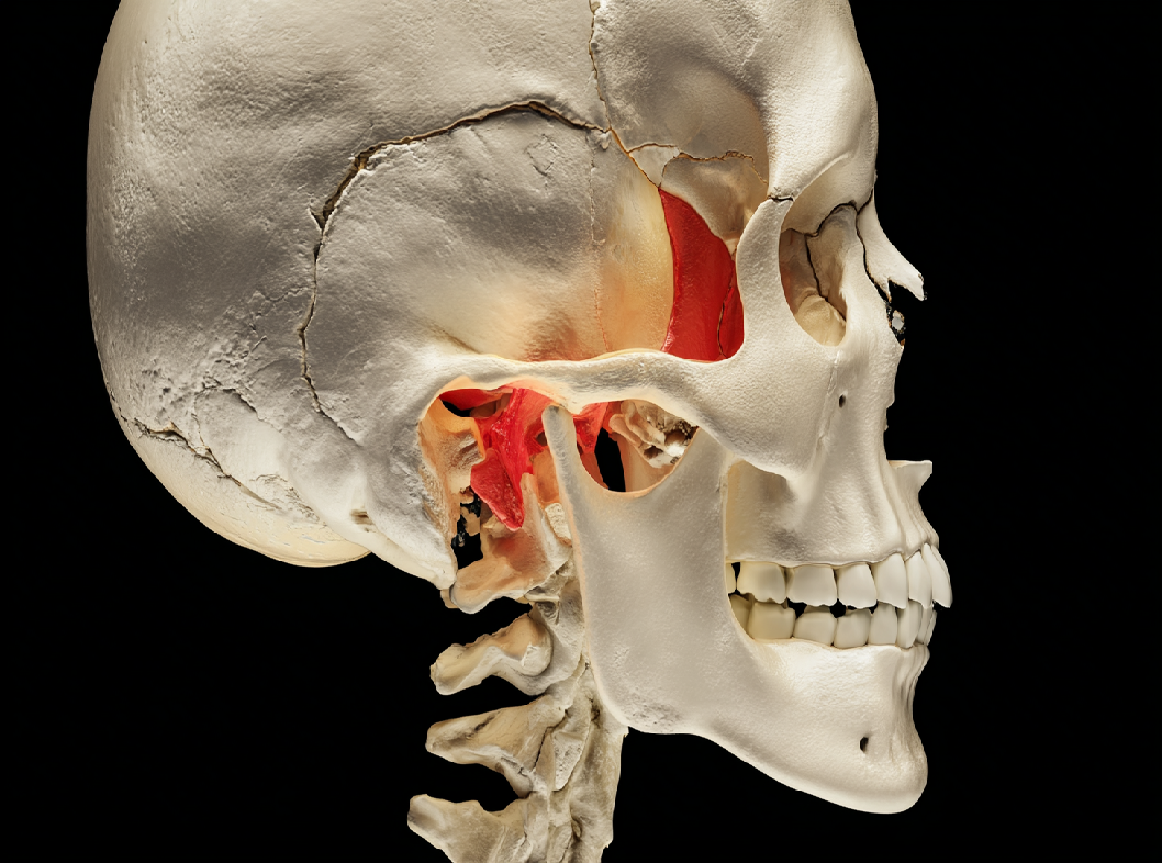 Перелом височной кости