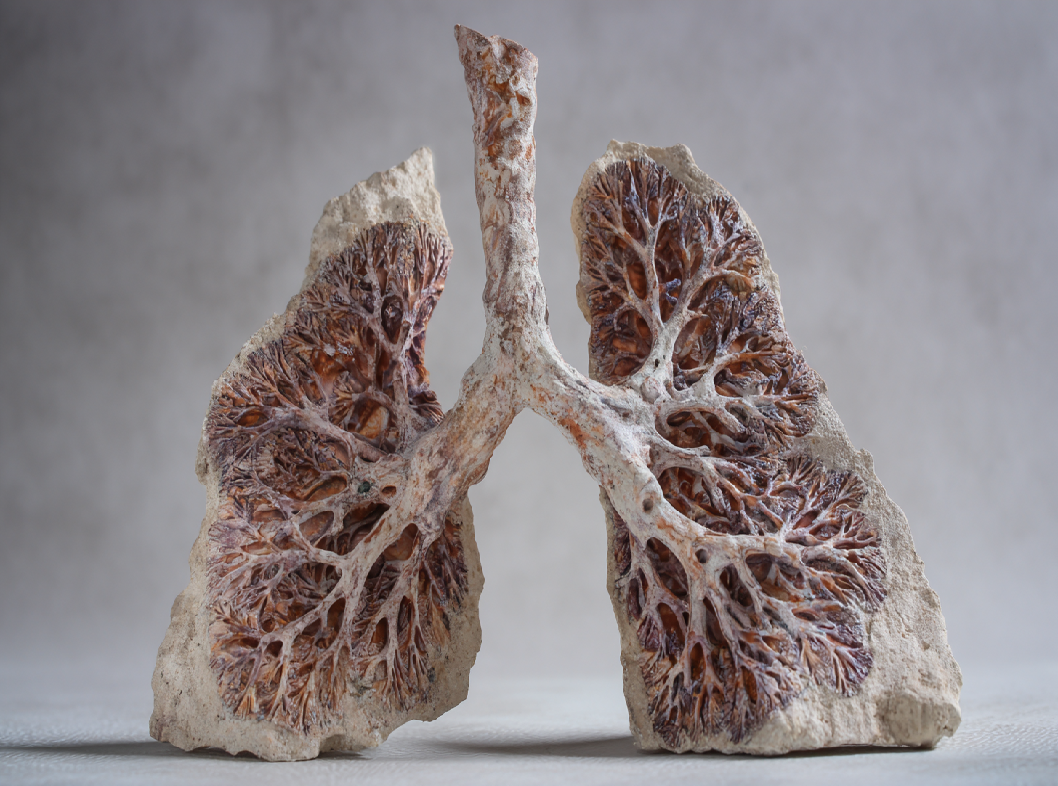 Гамартома легкого