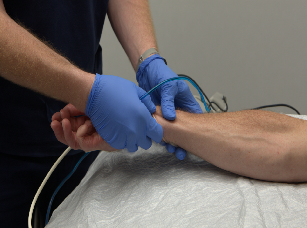 УЗДС вен верхних конечностей