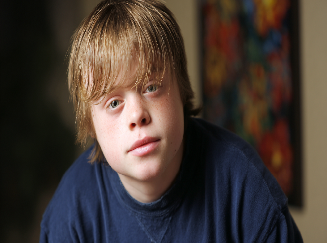 Синдром Дауна