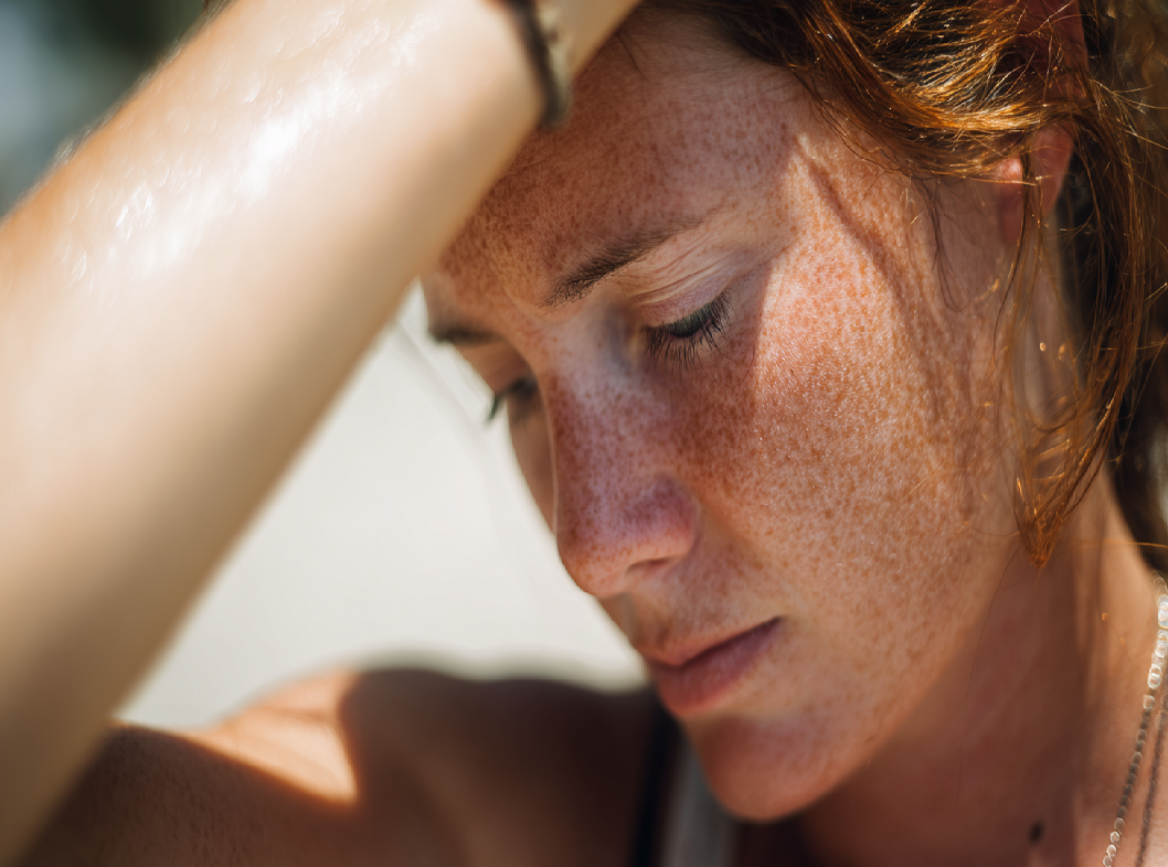 Потница у взрослых