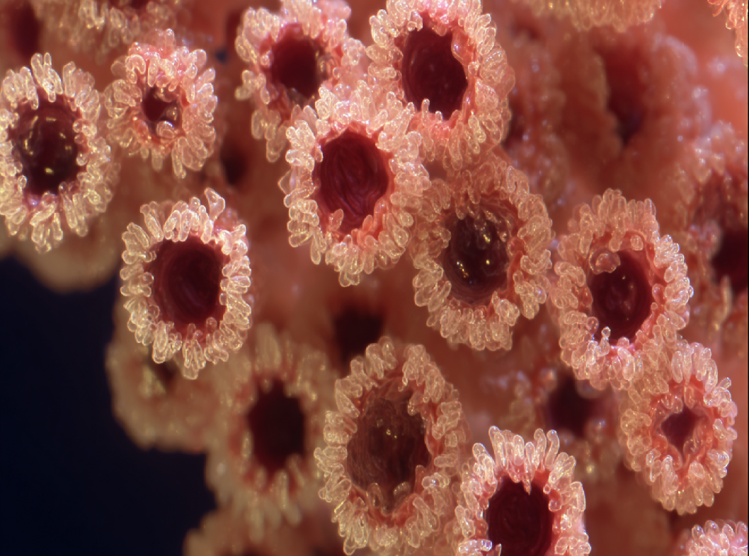 Полипы желудка