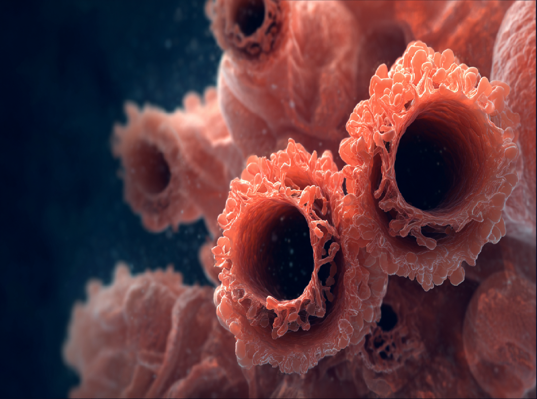 Полипы желудка