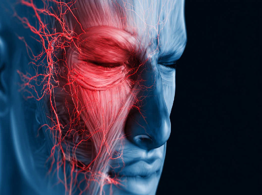 Неврит лицевого нерва